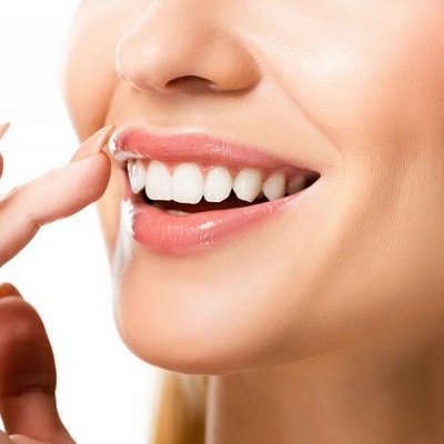 Composite Veneers in Dubai Composite Veneers Cost