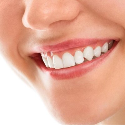 Gingivectomy Surgery in Dubai Gum Tissue Removal UAE