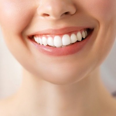 Dental Stains Removal in Dubai & Abu Dhabi Stain Treatment Price