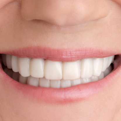 Teeth polishing & scaling