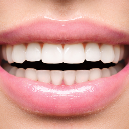 Teeth polishing & scaling dubai