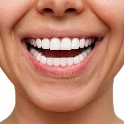 Cosmetic Dentistry A