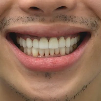 Cosmetic Dentistry B