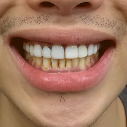 Cosmetic Dentistry Dubai B