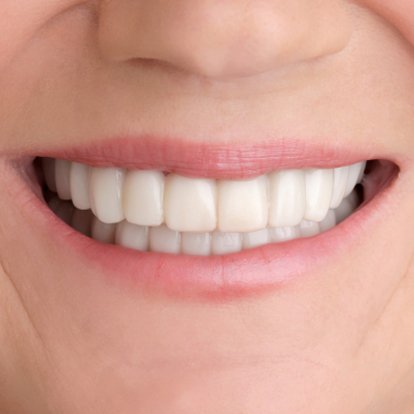 Cosmetic Dentistry in Dubai A