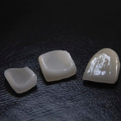 Best Zirconia Crown in Dubai - Dental Crowns