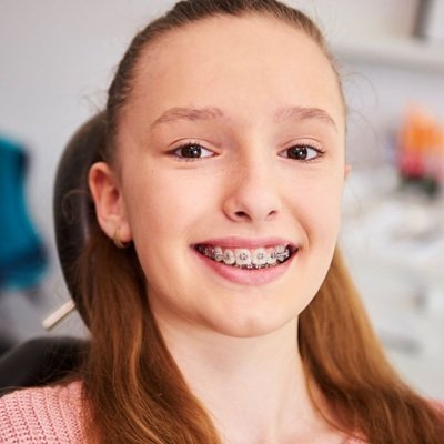 Protruding Teeth Treatment in Dubai - Enfield Dental Clinic